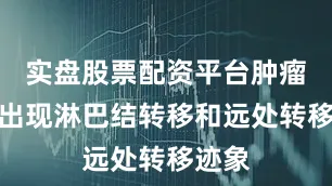 实盘股票配资平台肿瘤尚未出现淋巴结转移和远处转移迹象